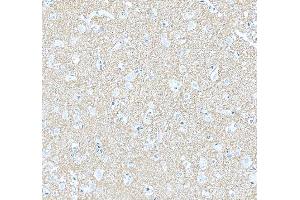 IHC analysis of Septin 3/SEPTIN3 using anti-Septin 3/SEPTIN3 antibody (ABIN7599288). (Septin 3 anticorps  (AA 1-339))