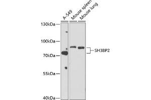 Western blot analysis of extracts of various cell lines, using SH3BP2 antibody (ABIN6130687, ABIN6147721, ABIN6147722 and ABIN6214417) at 1:1000 dilution. (SH3BP2 anticorps  (AA 392-561))