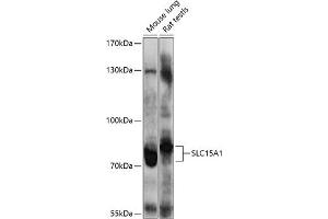 Western blot analysis of extracts of various cell lines, using SLC15 antibody (0246) at 1:1000 dilution. (SLC15A1 anticorps  (AA 600-700))