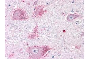 Immunohistochemical staining of Brain (Neurons and Glia) using anti- CHRM3 antibody ABIN122325 (CHRM3 anticorps  (C-Term))