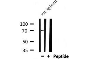 Western blot analysis of PLK3 expression in Rat spleen lysate (PLK3 anticorps  (Internal Region))