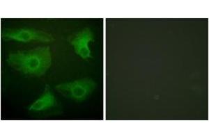 Immunofluorescence analysis of HeLa cells, using IkappaB-epsilon (Phospho-Ser22) Antibody. (IkappaB-epsilon anticorps  (pSer22))