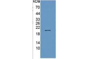 WB of Protein Standard: different control antibodies  against Highly purified E. (MME Kit ELISA)