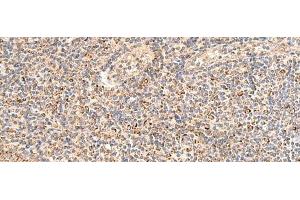 Immunohistochemistry of paraffin-embedded Human tonsil tissue using MRPL16 Polyclonal Antibody at dilution of 1:50(x200)