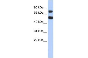 WB Suggested Anti-MGC42105 Antibody Titration: 0. (NIM1 anticorps  (Middle Region))