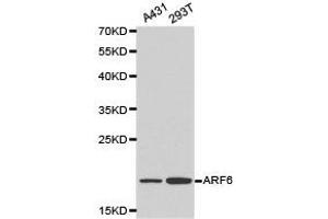 Western Blotting (WB) image for anti-ADP-Ribosylation Factor 6 (ARF6) antibody (ABIN1871073) (ARF6 anticorps)