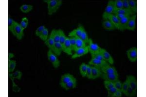 Immunofluorescence staining of HepG2 cells with ABIN7156434 at 1:133, counter-stained with DAPI. (ITGA3 anticorps  (AA 168-276))
