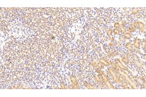 Detection of TGFbR3 in Mouse Kidney Tissue using Polyclonal Antibody to Transforming Growth Factor Beta Receptor III (TGFbR3)