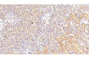 Detection of TGFbR3 in Mouse Kidney Tissue using Polyclonal Antibody to Transforming Growth Factor Beta Receptor III (TGFbR3) (TGFBR3 anticorps  (AA 469-724))