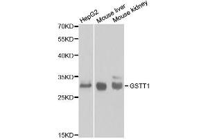 Western blot analysis of extracts of various cell lines, using GSTT1 antibody. (GSTT1 anticorps  (AA 1-240))