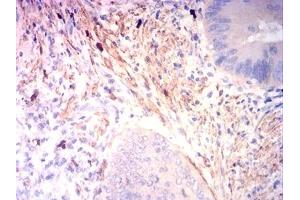 anti-Myoglobin (MB) (AA 2-154) antibody