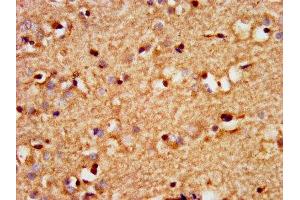 IHC image of ABIN7172623 diluted at 1:300 and staining in paraffin-embedded human brain tissue performed on a Leica BondTM system.