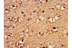 IHC image of ABIN7172623 diluted at 1:300 and staining in paraffin-embedded human brain tissue performed on a Leica BondTM system. (SOX3 anticorps  (AA 4-118))