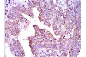 anti-Calcium/calmodulin-Dependent Protein Kinase IV (CAMK4) (AA 35-292) antibody