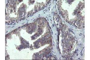 Image no. 4 for anti-Polymerase (RNA) III (DNA Directed) Polypeptide C (62kD) (POLR3C) antibody (ABIN1500340)