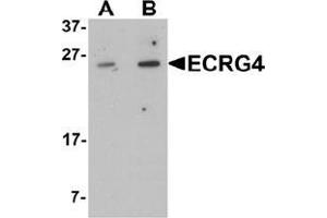Western blot analysis of ECRG4 in HeLa cell lysate with ECRG4 Antibody  at (A) 1 and (B) 2 μg/mL (C2orf40 anticorps  (C-Term))