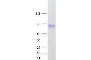Validation with Western Blot
