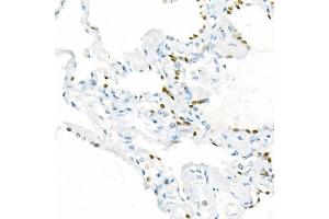 Immunohistochemistry of paraffin-embedded Human lung using TTF1 antibody (ABIN1679475, ABIN3017648, ABIN3017649 and ABIN7101514) at dilution of 1:1000 (40x lens).