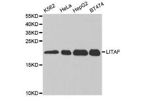 Western blot analysis of extracts of various cell lines, using LITAF antibody. (LITAF anticorps  (AA 1-161))