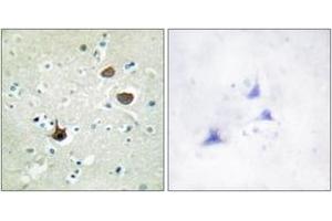 Immunohistochemistry analysis of paraffin-embedded human brain, using CXCR4 (Phospho-Ser339) Antibody. (CXCR4 anticorps  (pSer339))