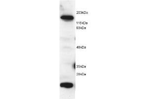 Image no. 1 for anti-5-Methyltetrahydrofolate-Homocysteine Methyltransferase (MTR) (C-Term) antibody (ABIN374080) (MTR anticorps  (C-Term))