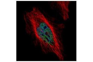ICC/IF Image Confocal immunofluorescence analysis (Olympus FV10i) of paraformaldehyde-fixed HeLa, using DYRK1B, antibody (Green) at 1:500 dilution.