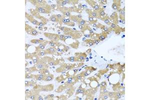 Immunohistochemistry of paraffin-embedded human liver injury using NDUFS3 antibody.