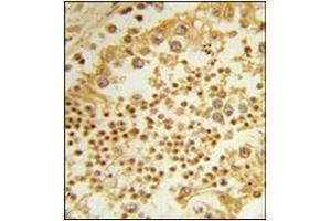 Immunohistochemistry analysis in Formalin Fixed, Paraffin Embedded Human Testis using RPL31 Antibody (Center) followed by peroxidase conjugation of the secondary antibody and DAB staining. (RPL31 anticorps  (Middle Region))