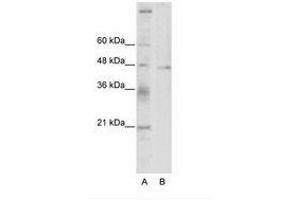 Image no. 1 for anti-Tumor Susceptibility Gene 101 (TSG101) (C-Term) antibody (ABIN202407) (TSG101 anticorps  (C-Term))
