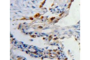 Used in DAB staining on fromalin fixed paraffin-embedded lung tissue (Latexin anticorps  (AA 1-222))