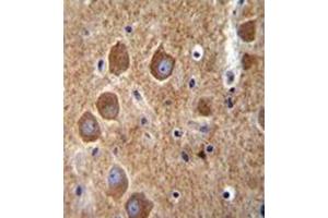 Immunohistochemistry analysis in formalin fixed and paraffin embedded human brain tissue reacted with AP53154PU-N, which was peroxidase conjugated to the secondary antibody and followed by DAB staining. (PAK6 anticorps  (Middle Region))