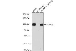 Immunoprecipitation analysis of 200 μg extracts of MCF-7 cells, using 3 μg  antibody (ABIN6127359, ABIN6136867, ABIN6136868 and ABIN6222919). (ANAPC5 anticorps  (AA 1-250))