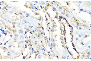Immunohistochemistry of paraffin-embedded Rat kidney using HYAL1 Polyclonal Antibody at dilution of 1:100 (40x lens).