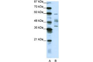 WB Suggested Anti-APTX Antibody Titration:  1. (Aprataxin anticorps  (N-Term))