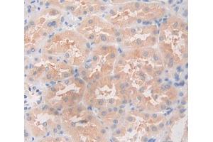 Used in DAB staining on fromalin fixed paraffin- embedded Kidney tissue (ANGPTL5 anticorps  (AA 141-383))