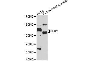 Western blot analysis of extracts of various cell lines, using HK2 antibody.