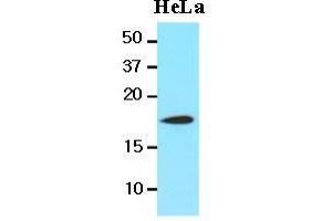 The lysates of HeLa(20 ug) were resolved by SDS-PAGE, transferred to nitrocellulose membrane and probed with anti-human Cofilin 1(1:1000) antibody. (Cofilin anticorps  (AA 1-166))