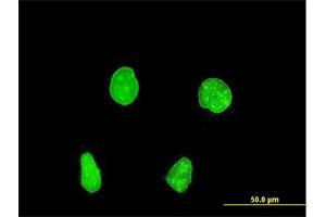 Immunofluorescence of monoclonal antibody to PAX8 on HeLa cell.
