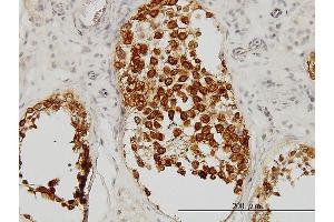 Immunoperoxidase of monoclonal antibody to DAZ1 on formalin-fixed paraffin-embedded human testis. (DAZ1 anticorps  (AA 21-120))
