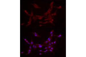 Immunofluorescence analysis of PC-12 cells using  Rabbit pAb (ABIN7265439) at dilution of 1:25 (40x lens).