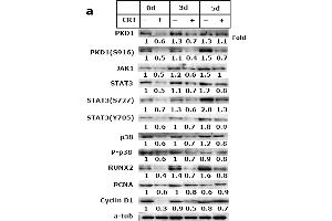PKD1 impaired osteoblast differentiation through JAK1/STAT3 and p38 signaling pathway.