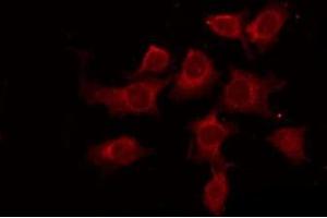 ABIN6269334 staining 293 by IF/ICC.