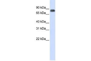Western Blotting (WB) image for anti-Macrophage Stimulating 1 (Hepatocyte Growth Factor-Like) (MST1) antibody (ABIN2458955)