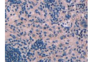 IHC-P analysis of Rat Spleen Tissue, with DAB staining. (PLA2G2D anticorps  (AA 20-134))
