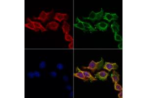 ABIN6256941 and ABIN6274588 staining Hela cells by IF/ICC.