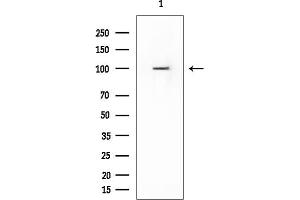 anti-rho GTPase Activating Protein 42 (ARHGAP42) (Internal Region) antibody