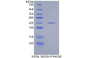 SDS-PAGE (SDS) image for Aconitase 1 (ACO1) (AA 527-719) protein (His tag) (ABIN1879370)