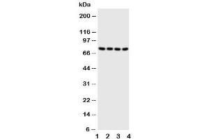 Western blot testing of PAK6 antibody and Lane 1:  HeLa (PAK6 anticorps  (N-Term))