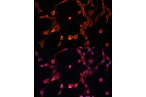 Immunofluorescence analysis of NIH/3T3 cells using P Glycoprotein antibody (ABIN6129943, ABIN6136341, ABIN6136344 and ABIN6216612) at dilution of 1:100. (ABCB1 anticorps  (AA 630-710))