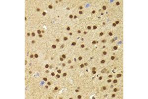 Immunohistochemistry of paraffin-embedded mouse brain using ANP32A Antibody.